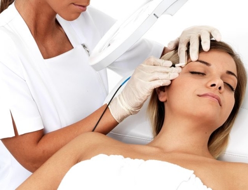 Sonde izolate; un „must” in electroliza!