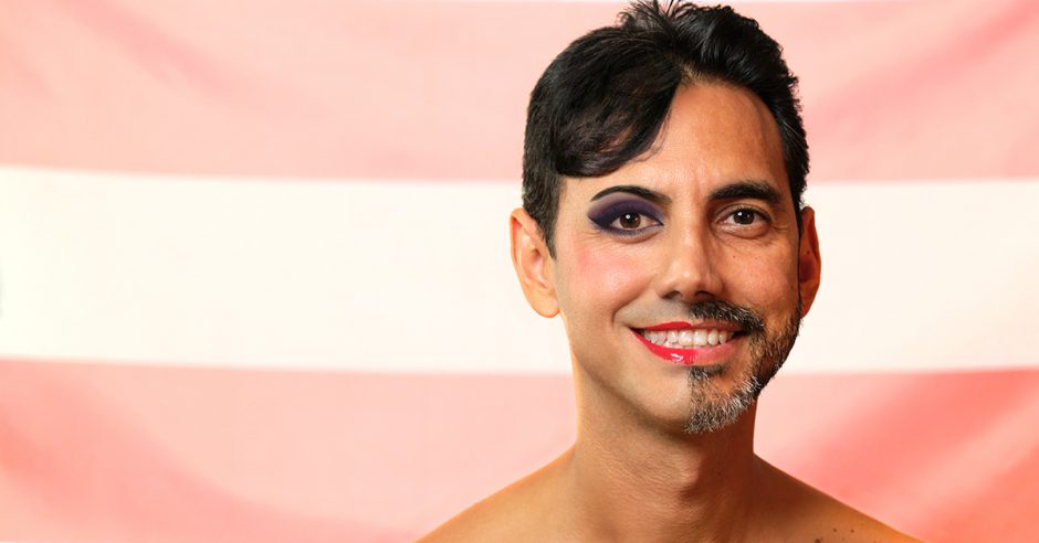 Transgender si indepartarea parului: electroliza, alegerea evidenta